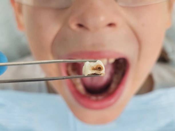 Best Walk-In Emergency Dental Services in Odenton, MD